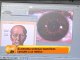 Método analiza el iris del ojo para diagnosticar enfermedades