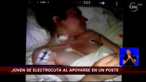 Estudiante de Talca se electrocuta tras apoyarse en un poste de luz - CHV Noticias