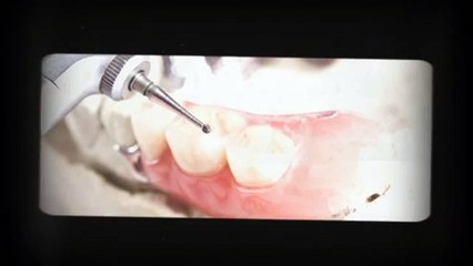 Arlington Texas Dentist