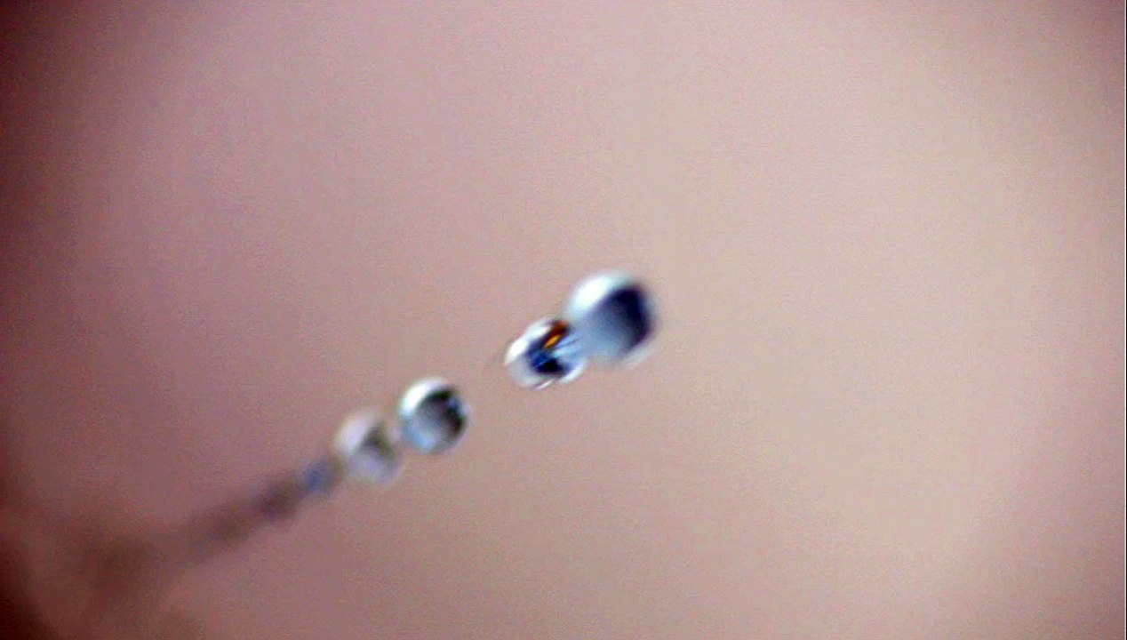 Audi - voiture - août 2009 - "Efficiency", "L'avance par la technologie", Audi Injection, Les aiguilles