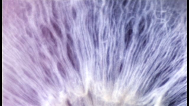 Institut National du Cancer (Inca) - lutte contre le cancer, Recherche sur les cancers, tout s'accélère - janvier 2012 - teaser, L'oeil