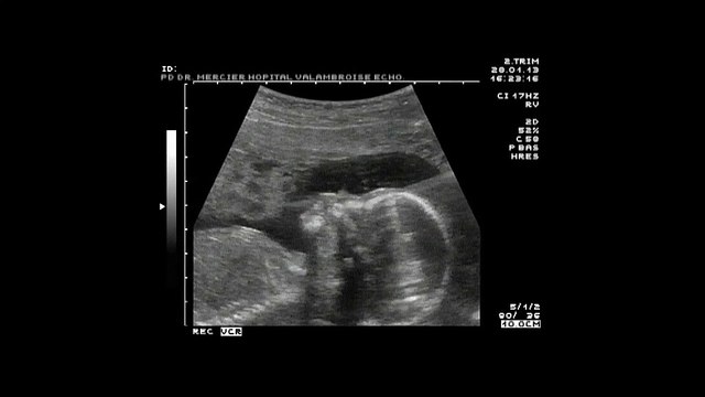 Publicis Consultants pour Service d'information du gouvernement (SIG) - lutte contre les inégalités, La vie de Léa - mars 2013