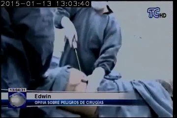 Precauciones que se deben tomar antes de una cirugía estética