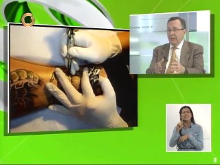 Tratamientos para eliminar tatuajes son graduales