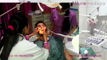 Dental Teeth Post And Core