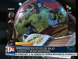 Ingeniero colombiano diseña manos en 3D para niños de bajos recursos