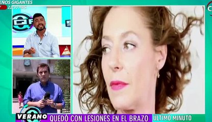 Claudia Di Girolamo quedó con lesiones en el brazo tras violento asalto - SQP