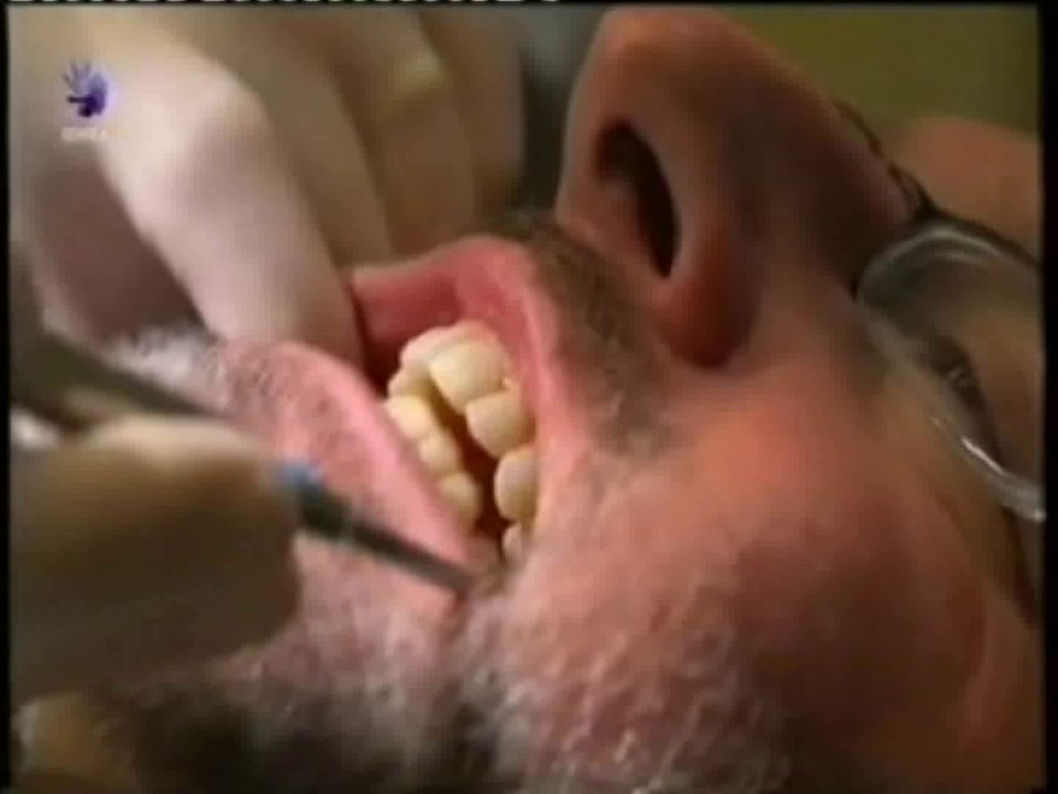 Dientes: Nuestro reptil interior