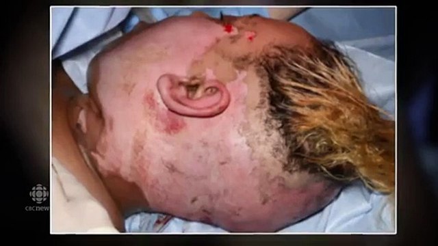 Cette jeune tatoueuse a une méthode géniale pour venir en aide aux grands brûlés !