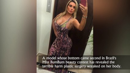 Plastic surgery Horribly gone wrong for Miss BumBum Contestant, Andressa Urach