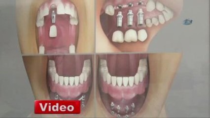 Türkiye Macaristan ve Polonya ile Yarışıyor