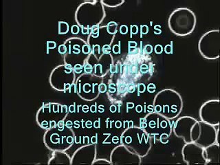 Doug Copp The most poisoned blood in the world