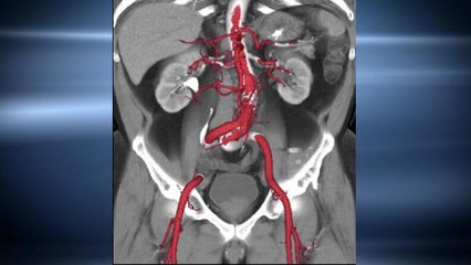 Brains, Veins and Bones Revealed With GE Scanner