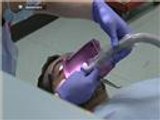 تقنية بريطانية جديدة لعلاج الأسنان