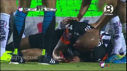 Choc de la tête brutal entre Ariel Nahuelpan et Jesus Zavala 17/01/2015