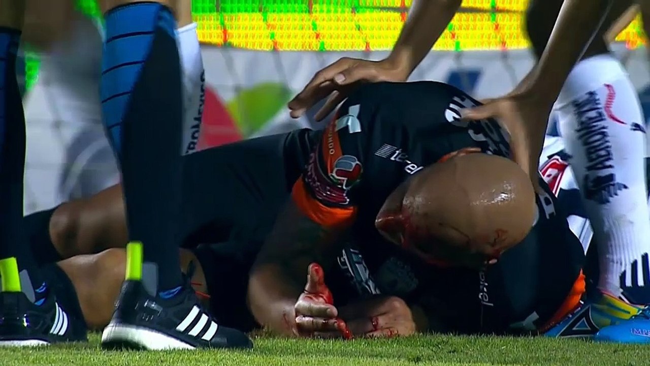 Liga MX: Monster-Platzwunde nach Zusammenstoß