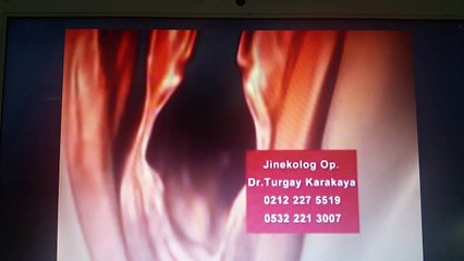 Kızlık Zarı Dikimi Fiyatı 2015 İstanbul