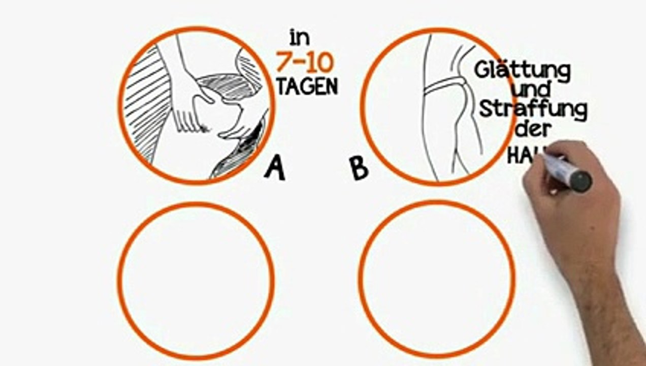 Was tun gegen Cellulite - Was hilft wirklich gegen Cellulite - Weg mit Cellulite