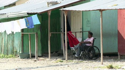 Amputados luchan por salir adelante en Haití