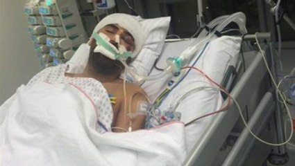 Almanya'da Türk Genci Burkan, Saldırıya Uğradı