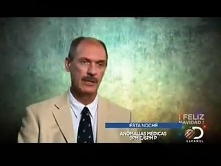 Raro, Real e Insólito- Las Curas más Bizarras del Reino Animal