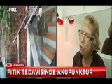 Akupunktur ile Bel ve Boyun fıtığı tedavisi olanlar iki büklüm gelip yürüyerek çıkıyorlar