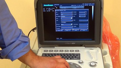 SonoScape A6 Ultrasound / Basic Functions