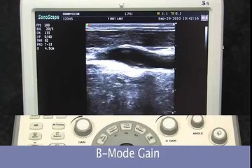 SonoScape S8 Color Doppler Ultrasound Machine Setup Keyboard