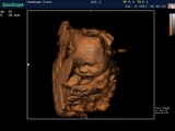 4D Sonoscape S8 Color Doppler Ultrasound / Real Baby