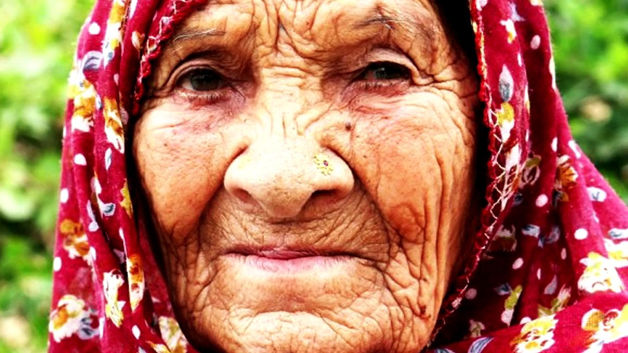 25 Bizarre Genetic Anomalies You Won't Believe Are Real