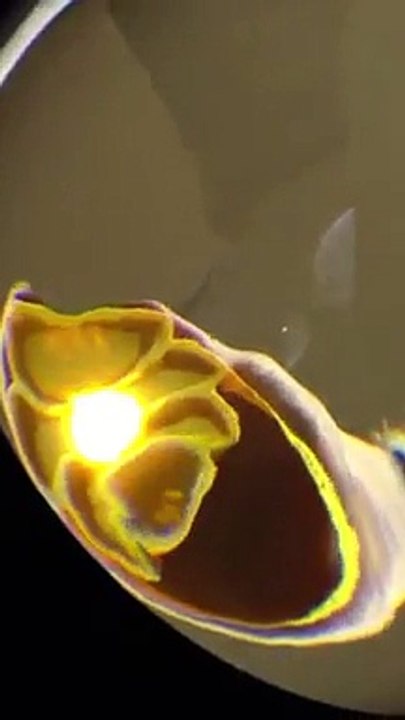 Little sun light transforming...