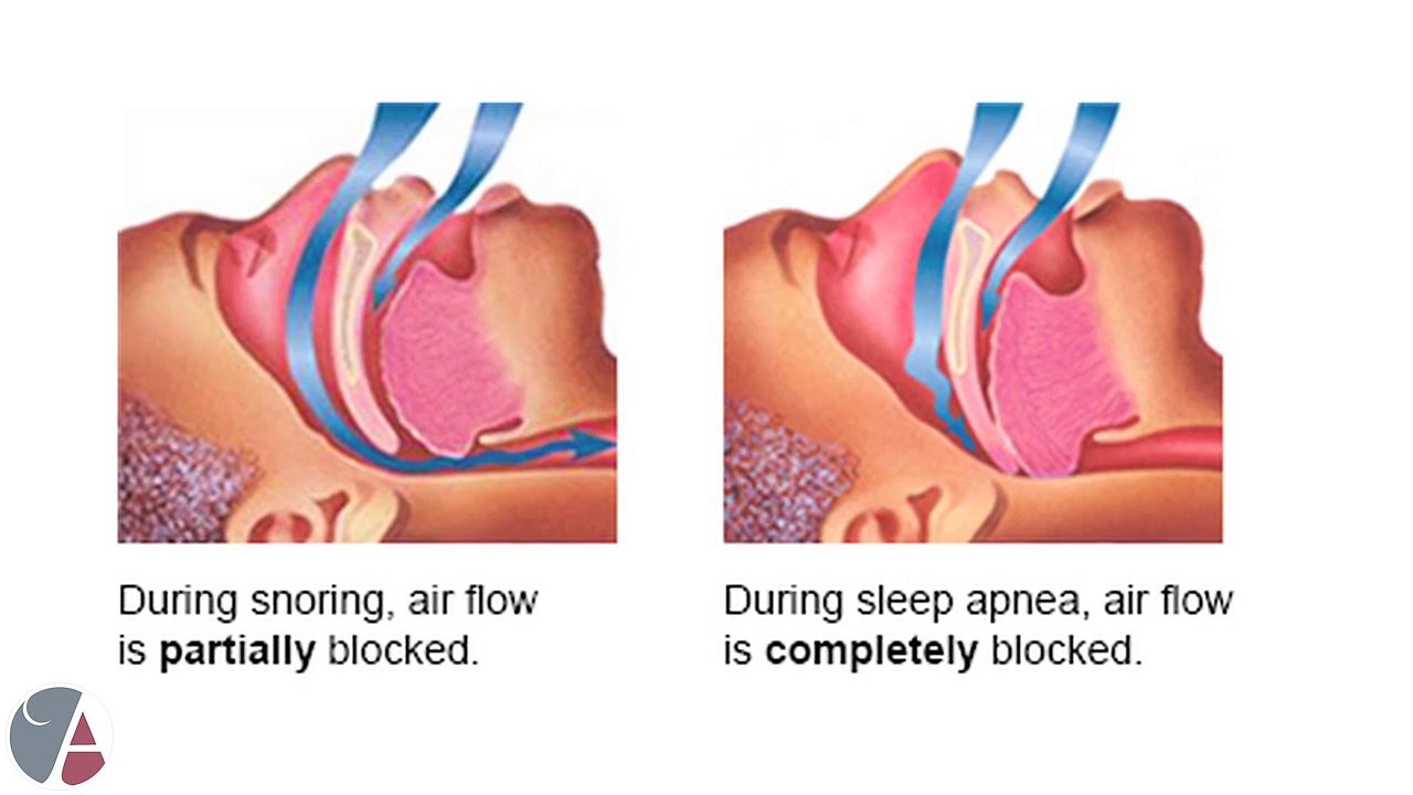 A Short Guide to Sleeping Disorders, with Dr. Blake Perkins