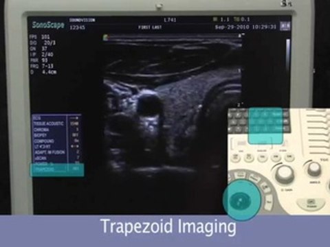Display Format Tutorial / Sonoscape S8 Ultrasound