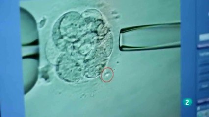 Corea de Huntington: Diagnostico genetico preimplantacional (DGP)