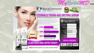 Black Diamond Skin Serum Review
