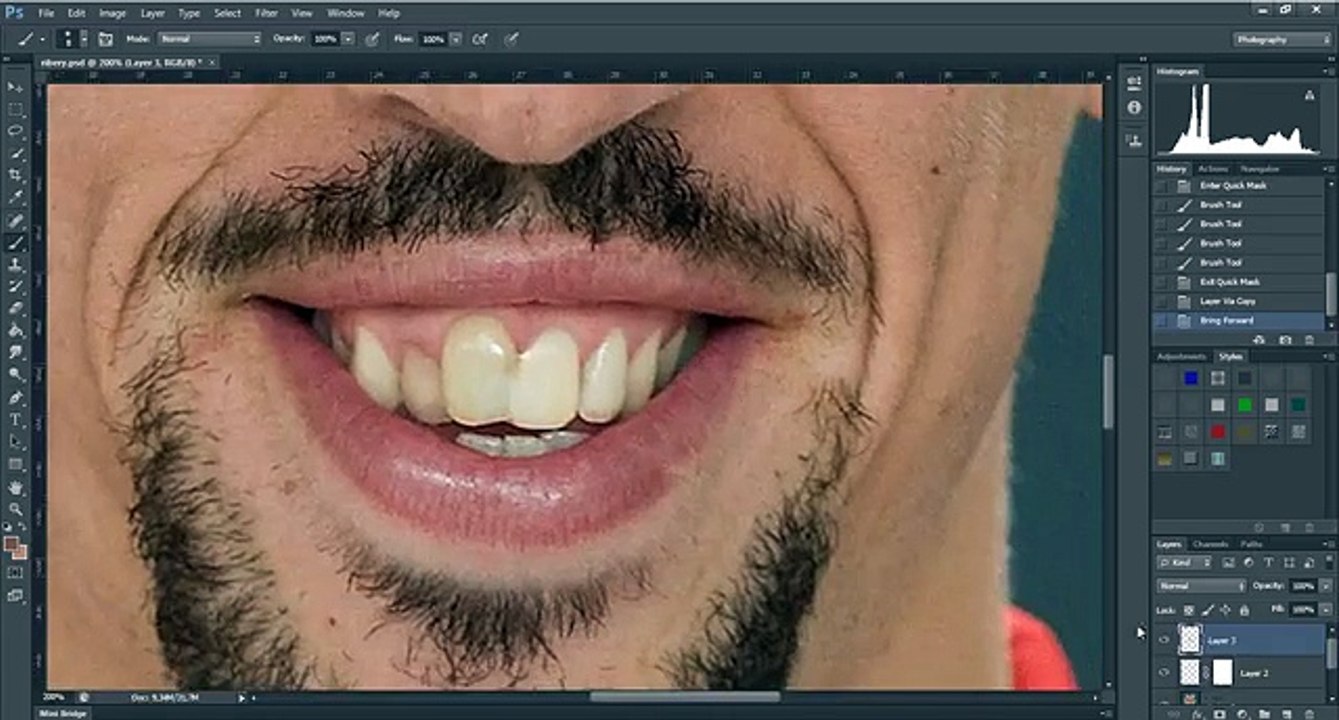 À quoi ressemblerait Franck Ribéry s'il n'avait pas de cicatrices ?