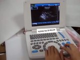3D Function Ultrasound Scanner XK200 / Keebomed Inc (1)