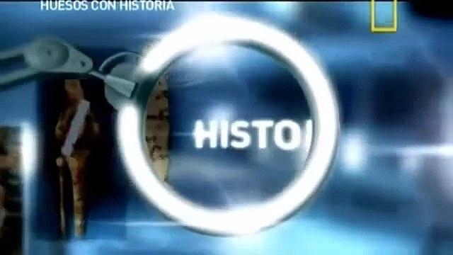 Forenses, Huesos con Historia-La chica de los huesos cruzados