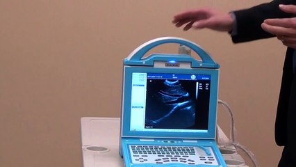 Veterinary KX5600V Animal Echo Ultrasound / DICOM Standard / For Sale Get Prices