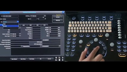 Chison ECO1 LED Most Affordable Human Ultrasound Scanner / Features - Tutorial