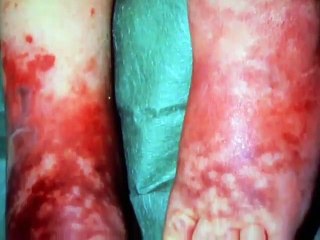 El Cuerpo (El orígen de las especies)-Historia