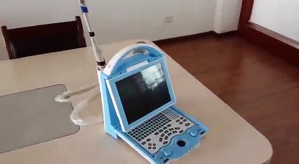 KX5600 Portable Ultrasound by Kaixin Newest Model with LED Screen