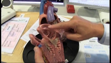 Las infecciones bacterianas del corazón