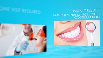 1 Hour Laser Teeth Whitening Treatment in Uk at Celeb Teeth Whitening
