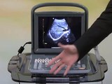 Inexpensive Chison ECO 1 Ultrasound / Product Introduction