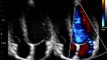 Chison Imaging Q9 Cardiac BBC Ultrasound Image-Recomemned fro eco cardiography