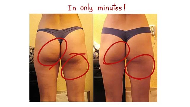 how to get rid of cellulite _ cellulite treatment _ kim kardashian cellulite treatment1