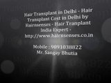 Hair Transplant in Delhi, Hair Transplant Cost in Delhi, Hair Restoration in Delhi