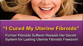 Fibroids Miracle Review + Bonus