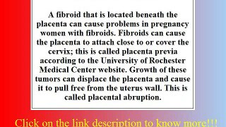 Fibroids pregnancy Risk